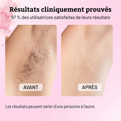 SOYÉA - Huile de Cyperus rotundus