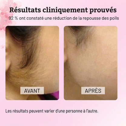 SOYÉA - Huile de Cyperus rotundus