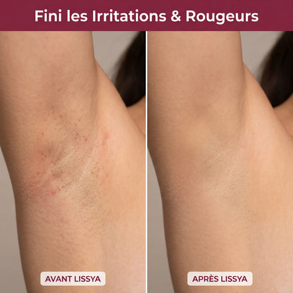 LISSYA - Un rasage doux, dès le premier passage